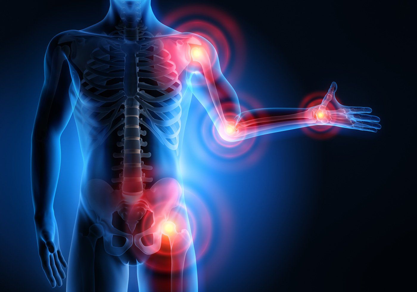 Pain On Joints – St. Augustine, FL – Pain Management Specialists