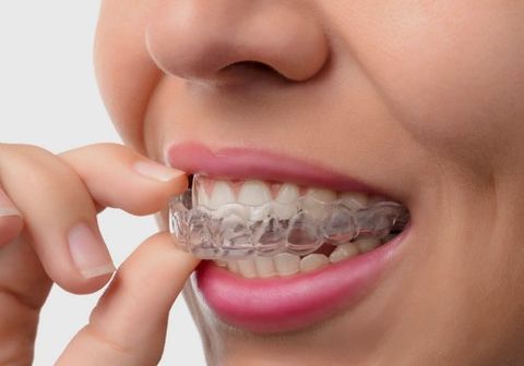 a lady holding the dentures