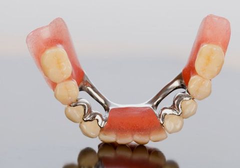 Acrylic dentures
