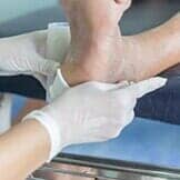 Infected Wound of Diabetic — Diabetic Foot Care in Chicago, IL Infected Wound of Diabetic — Diabetic Foot Care in Chicago, IL