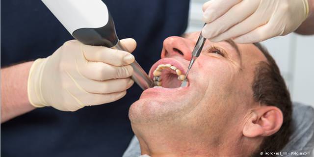 Cerec: Digitale Aufnahme
