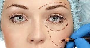 Blepharoplasty in cancun mexico
