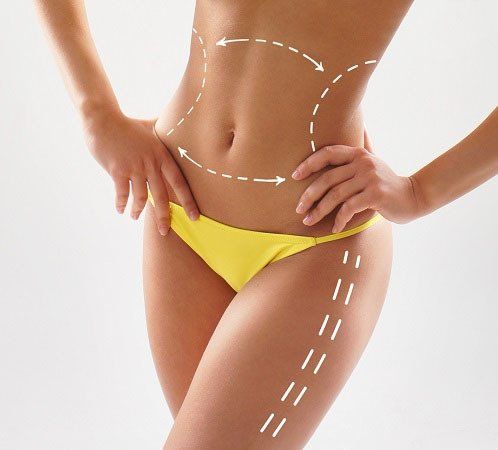 liposuction in puerto vallarta