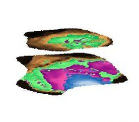 tree-surgery--cupar-blebo-tree-surgery--tomography
