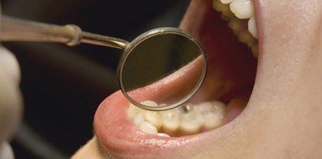 Root canal treatment