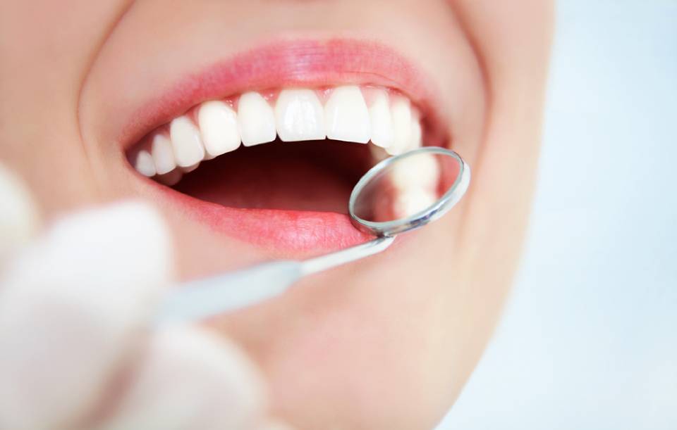 controllo arcata dentale superiore con specchietto