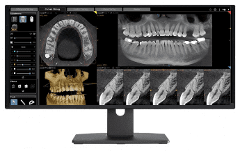 3d Cone Beam — Dental Services in Pueblo, CO 3d Cone Beam — Dental Services in Pueblo, CO