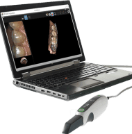 3d Imaging — Dental Services in Pueblo, CO 3d Imaging — Dental Services in Pueblo, CO