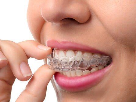 Wearing Orthodontic Silicone Trainer - TMJ Treatments in Lynbrook, NY