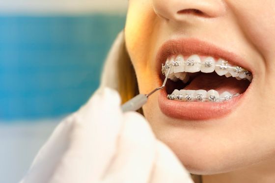 A girl undergoing routine maintenance on her braces near Canningvale