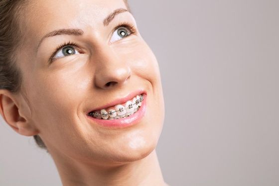 One of our custom orthodontics patients in Leeming