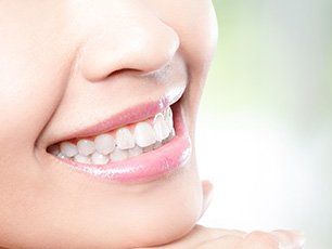 Contact us for teeth whitening