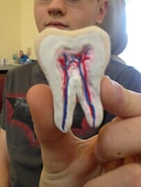 Model Tooth - Dentist in Hamburg, NY Model Tooth - Dentist in Hamburg, NY