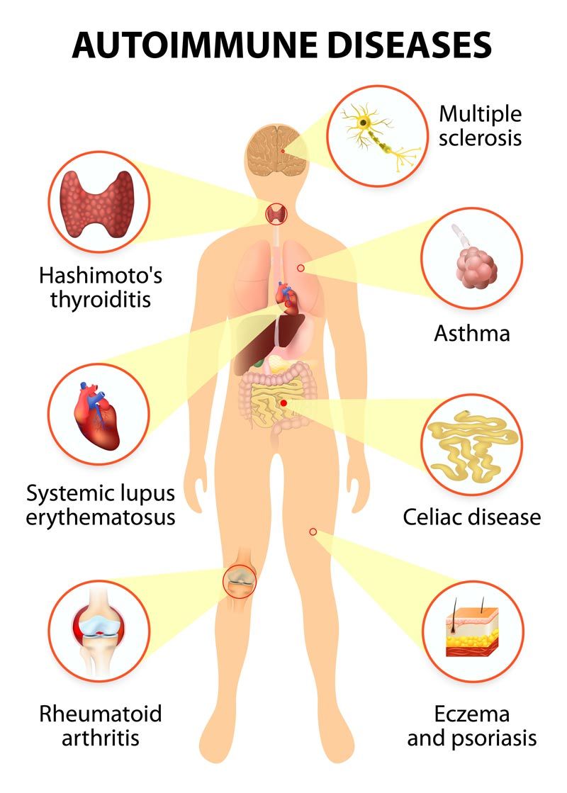 Click to Enlarge Holistic Healthcare Treatments for tissues of the human body affected by autoimmune attack