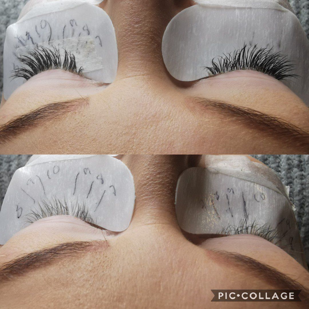 A close up of a woman 's eyes with ice cubes on them