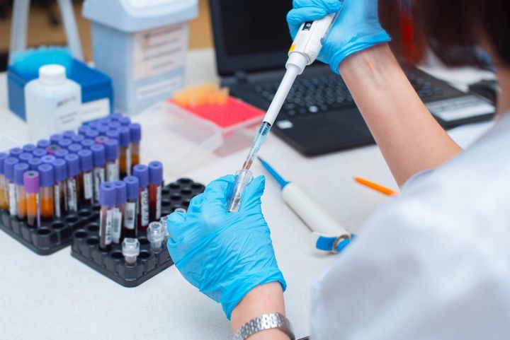 Campioni in laboratorio