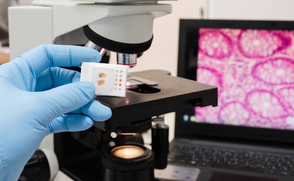 Analisi al microscopio