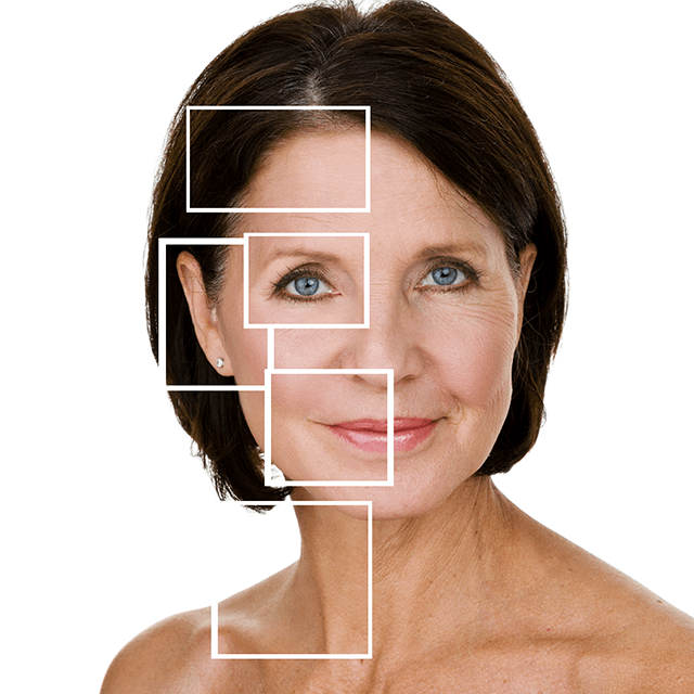 Wrinkle relaxing Sarah Burns Orthodontics