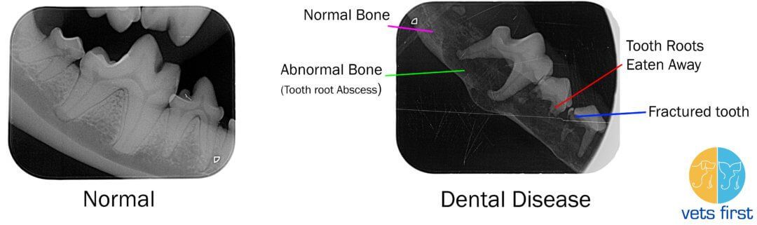 Bacteria on teeth