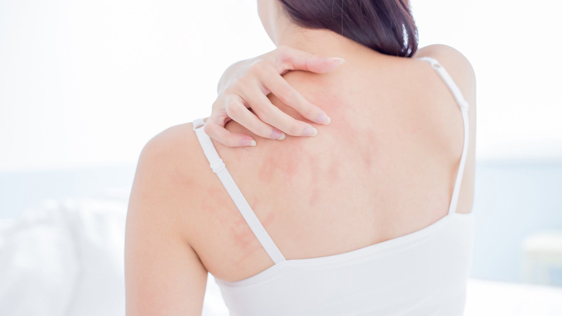 Skin Rashes — Voorhees, NJ — Bennett K. Schwartz, M.D. Skin Rashes — Voorhees, NJ — Bennett K. Schwartz, M.D.