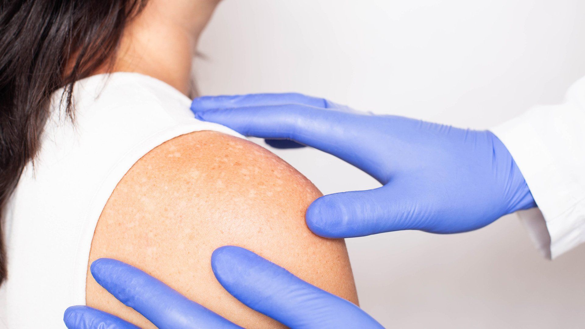 Dermatologist Conducts Medical Examination — Voorhees, NJ — Bennett K. Schwartz, M.D. Dermatologist Conducts Medical Examination — Voorhees, NJ — Bennett K. Schwartz, M.D.