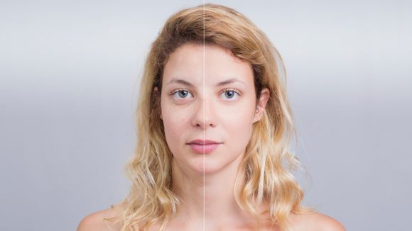 Before And After Treatment — Voorhees, NJ — Bennett K. Schwartz, M.D. Before And After Treatment — Voorhees, NJ — Bennett K. Schwartz, M.D.