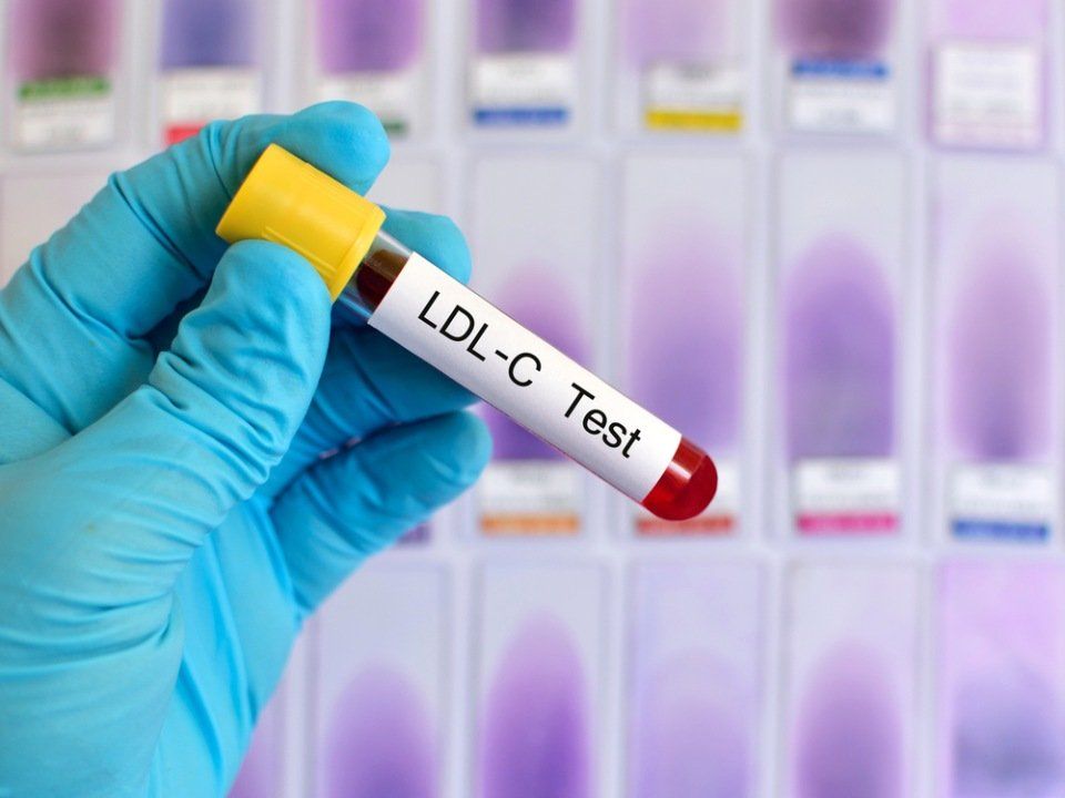 Fiala di test