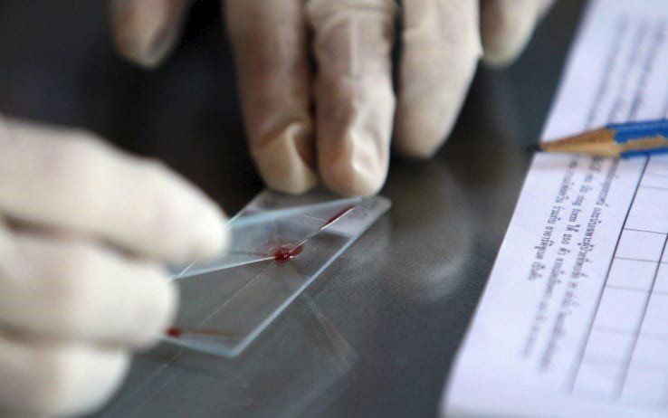 Mani guantate che maneggiano un vetrino e una pipetta vicino a un modulo su un tavolo da laboratorio.