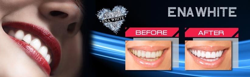 The Smile Lighting System
