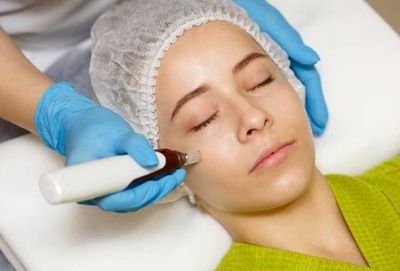 Micro-Needling — Dermatology Clinic in Kenner, LA Micro-Needling — Dermatology Clinic in Kenner, LA