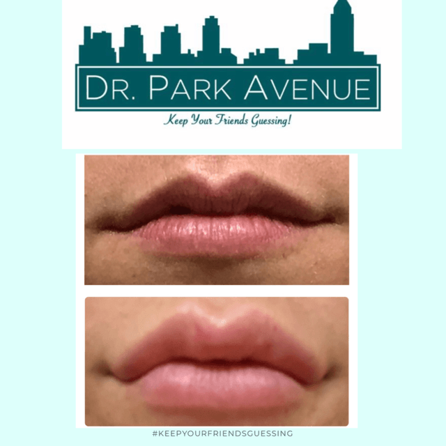 Before and after of lips, with logo 