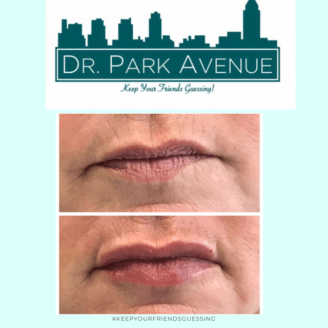 Before and after photos of lip enhancement, with a clinic logo above.