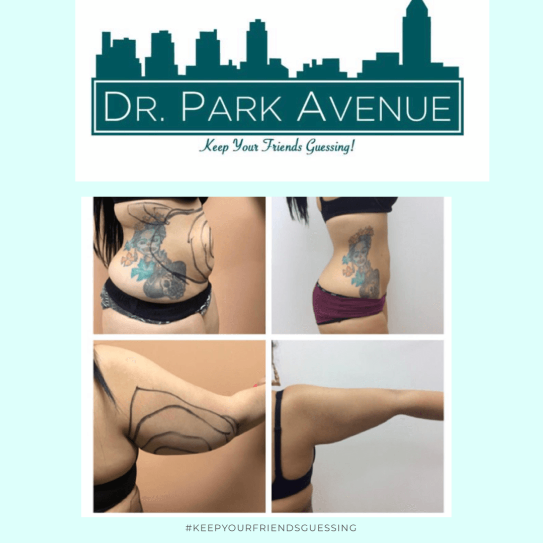 Before and after photos of body contouring treatments, with the doctor’s logo and tagline “Keep Your Friends Guessing!”