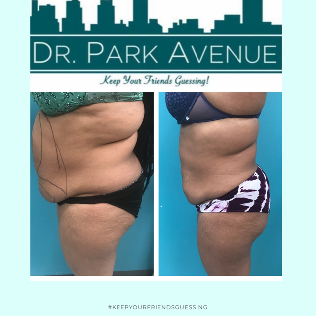 Before and after body contouring results, with a blue background and urban skyline.