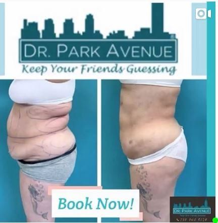 Before and after body transformation. Side view of a woman's torso, showing excess skin before and tightened appearance after a procedure.