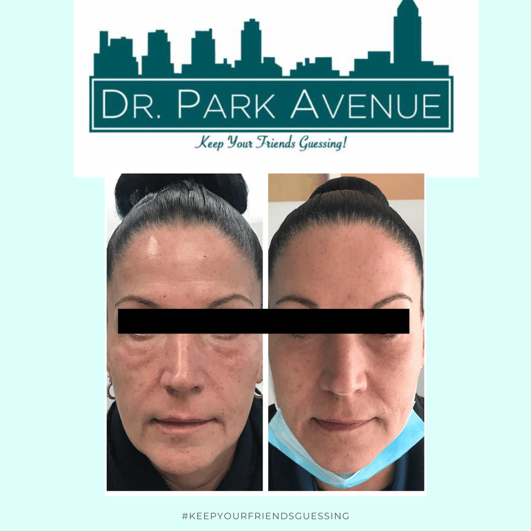 Before and after facial photo, with the Dr. Park Avenue logo at the top. The 