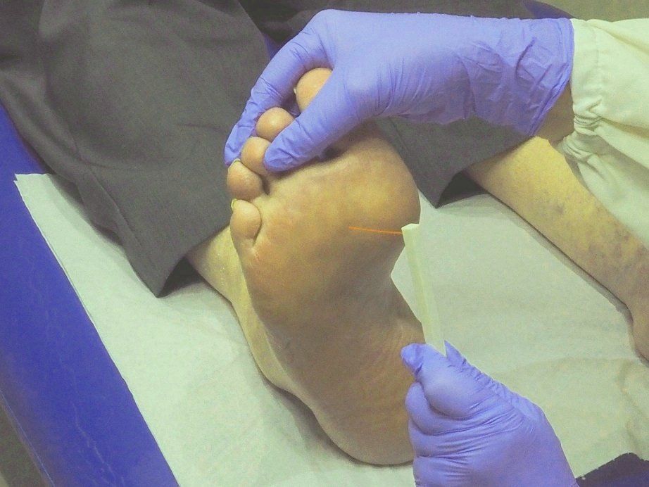 Diabetic foot care