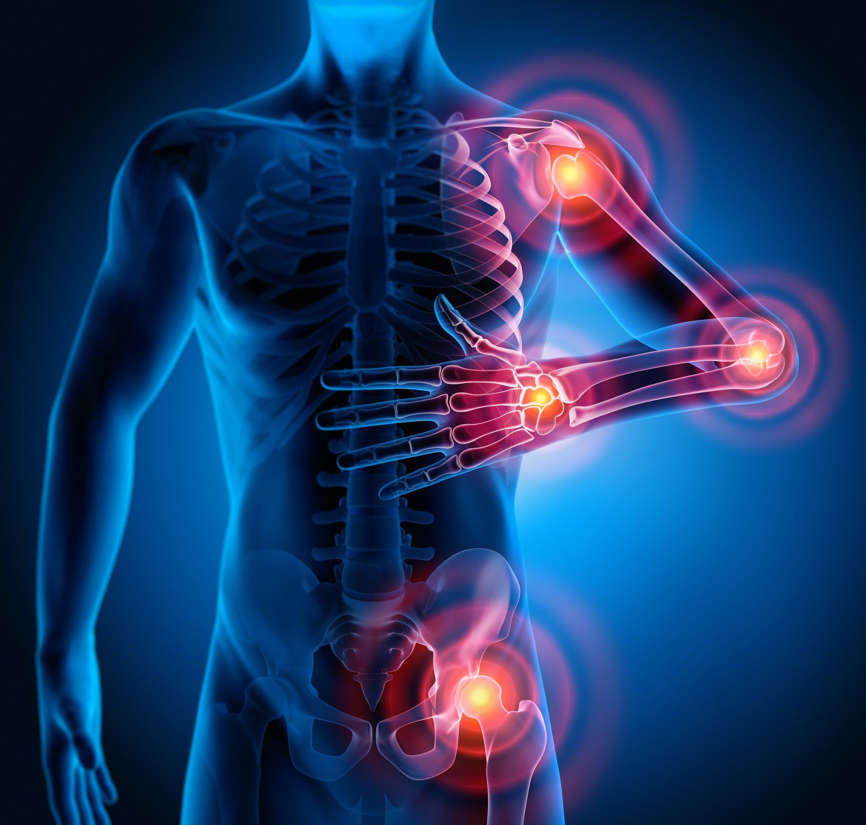 Illustration of Joint Pain | Albany, NY | Capital District Interventional Spine & Rehabilitation PLLC