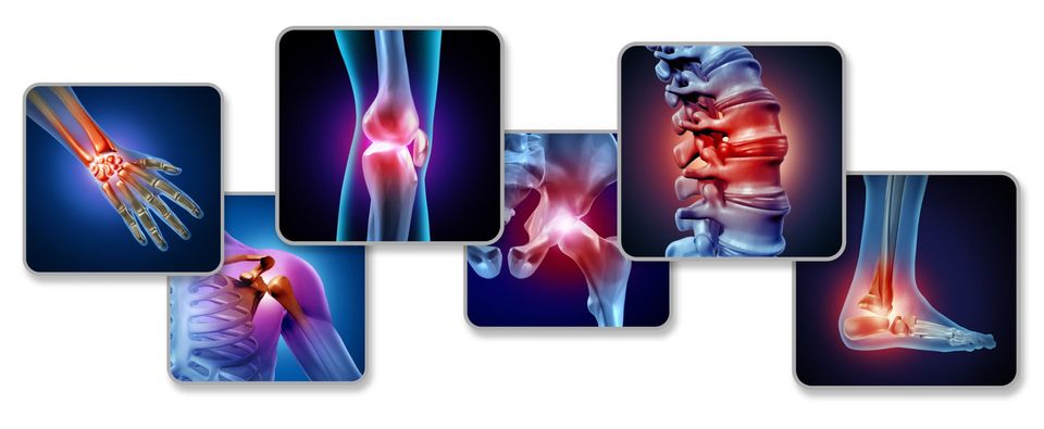 Joint Pain Illustration | Albany, NY | Capital District Interventional Spine & Rehabilitation PLLC Joint Pain Illustration | Albany, NY | Capital District Interventional Spine & Rehabilitation PLLC