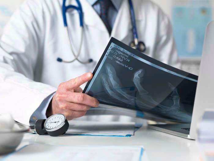 Medical Malpractice — Doctor Looking On A Patient's Xray in Miami, FL Medical Malpractice — Doctor Looking On A Patient's Xray in Miami, FL