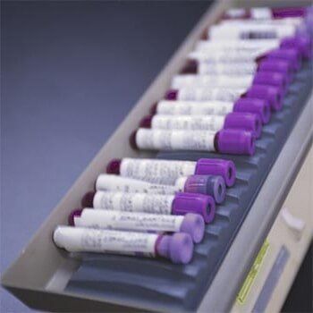 Laboratory Tool — Emergency Care in Smyrna, TN Laboratory Tool — Emergency Care in Smyrna, TN