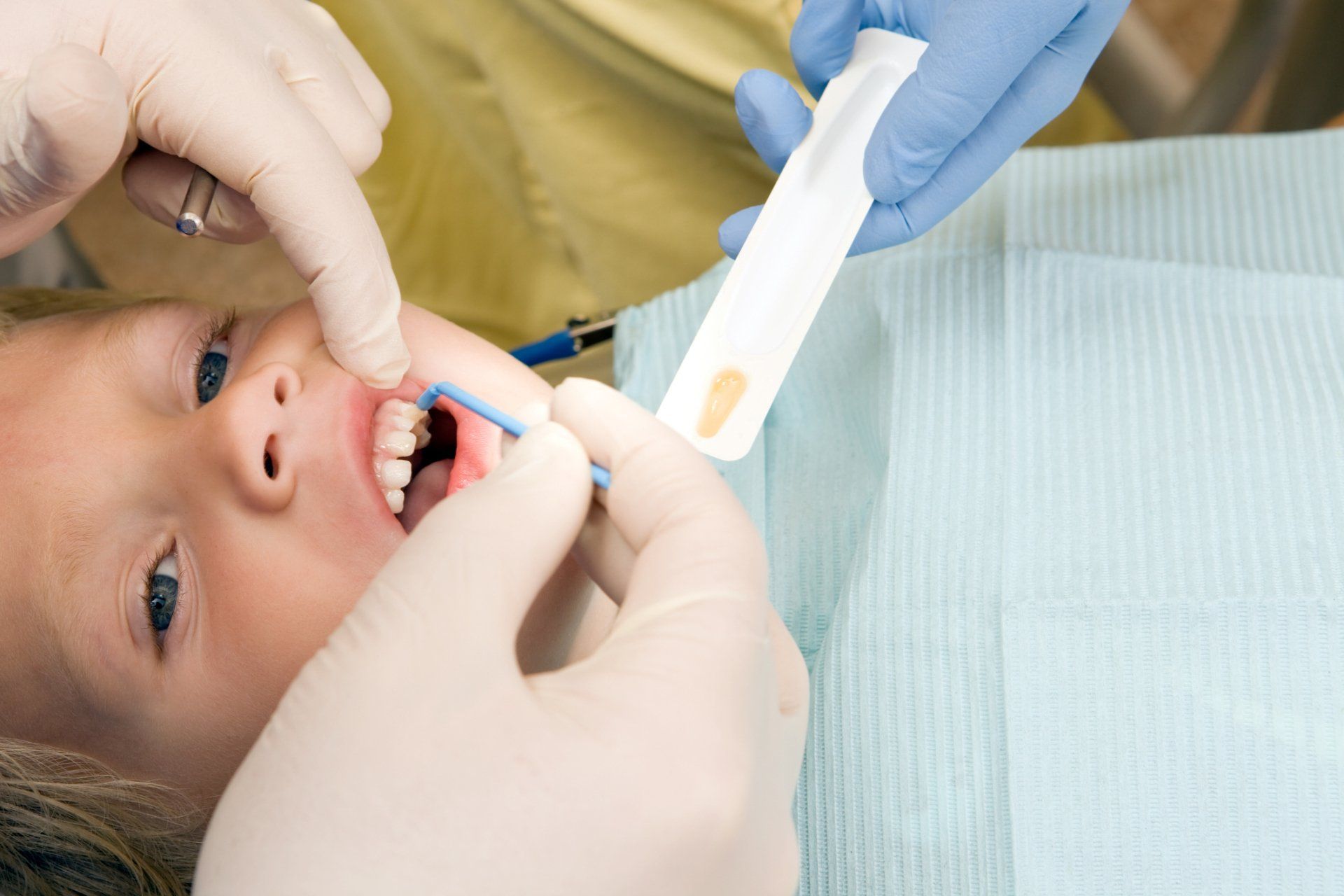 A dentist examining a young child's teeth with a swab in a dental setting.