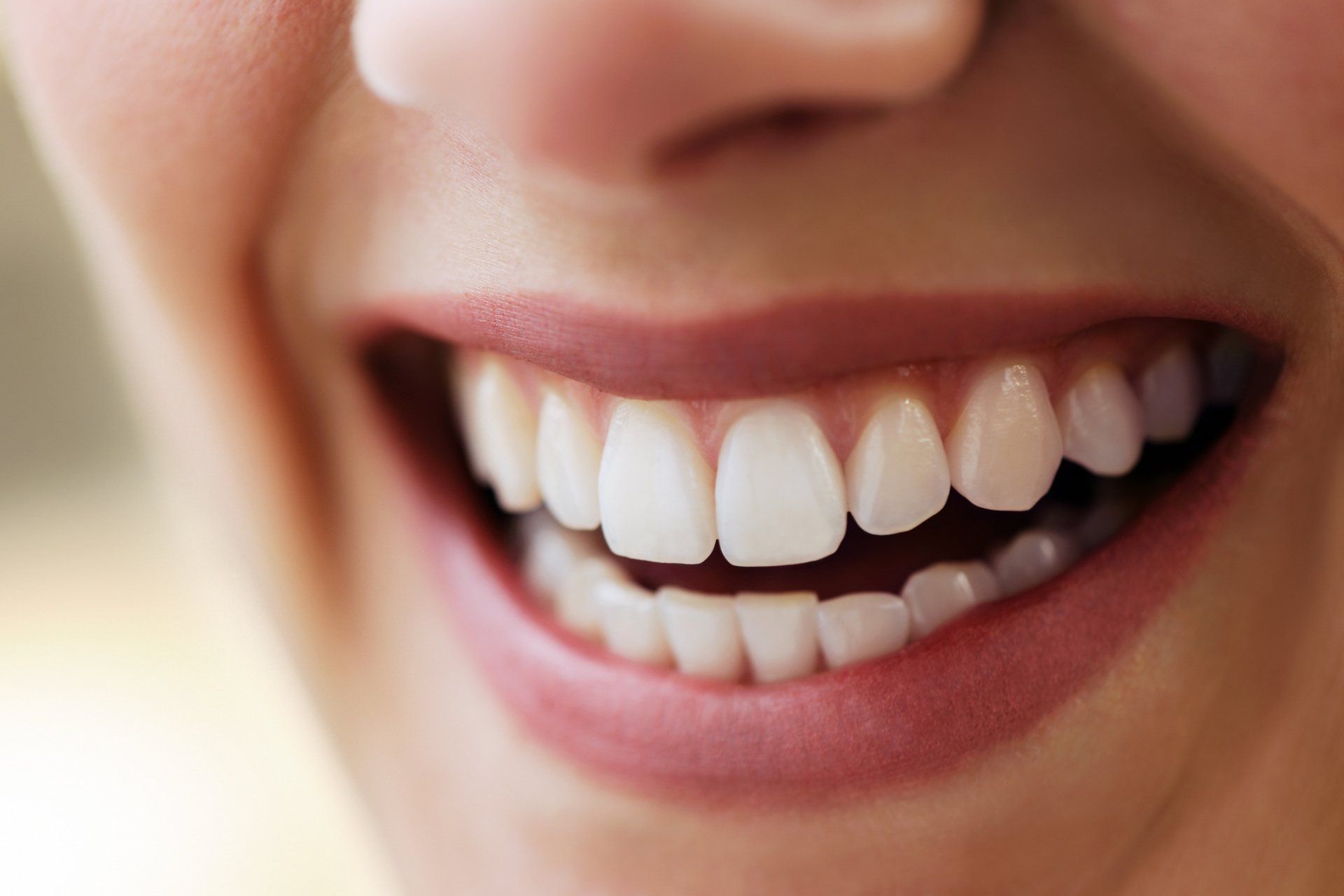 Full Mouth Reconstruction