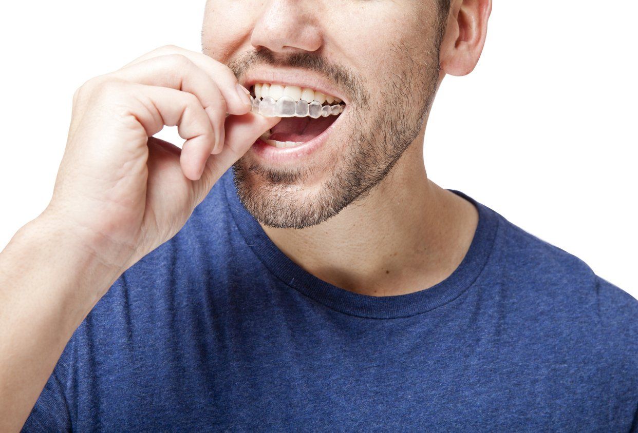 man using Invisalign