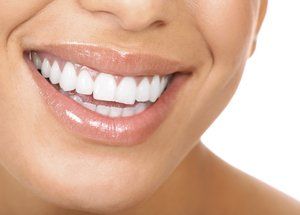 woman smiling with white teeth