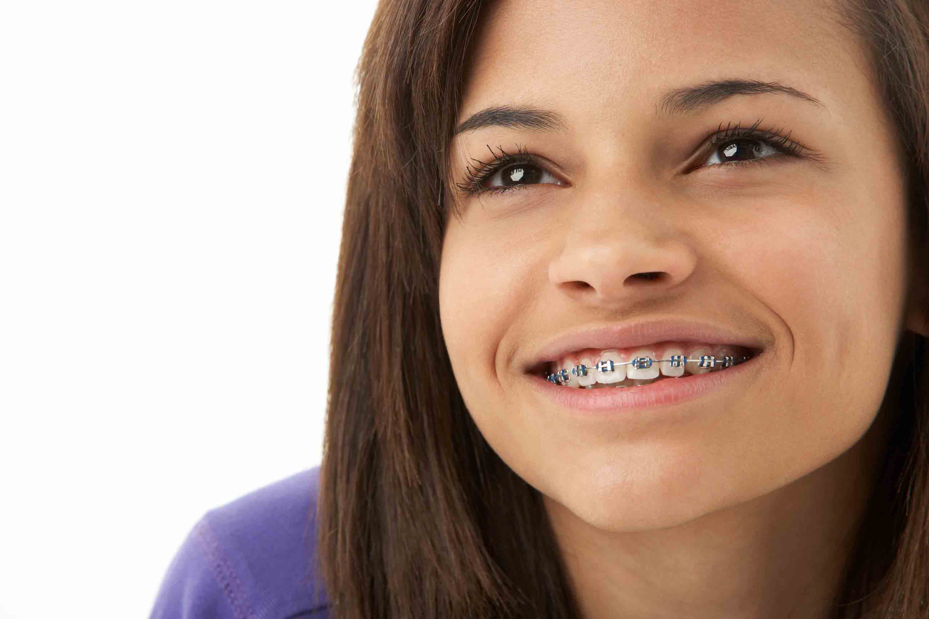 girl smiling with braces