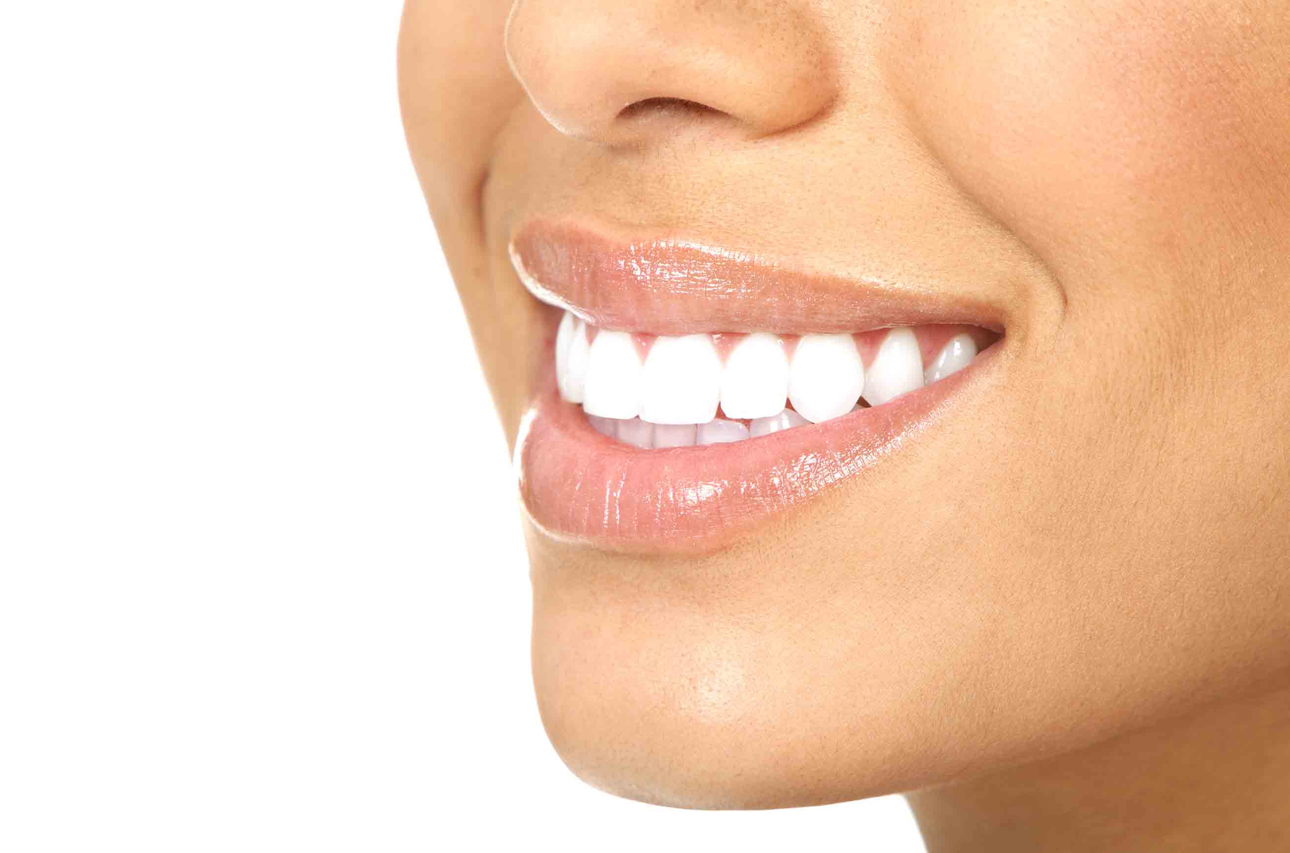 bright white teeth