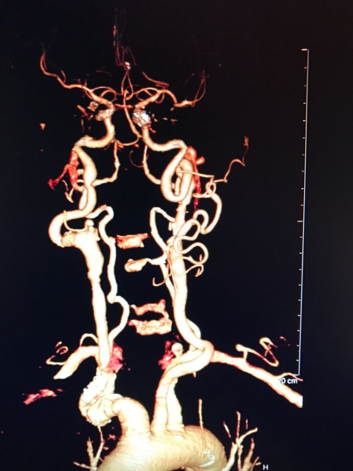 arterie