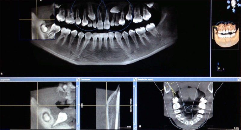 panoramica denti