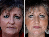 anti ageing, skin care, wrinkles, youthful, skin, younger skin